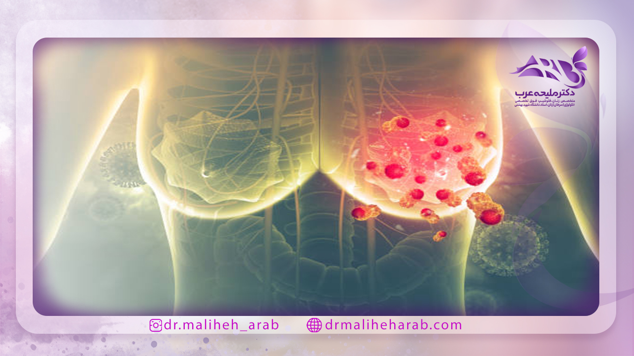 بارداری بعد از درمان سرطان پستان