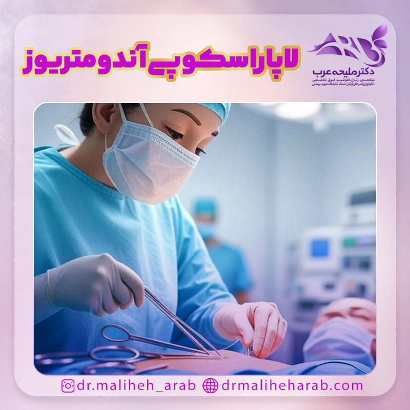 لاپاراسکوپی آندومتریوز