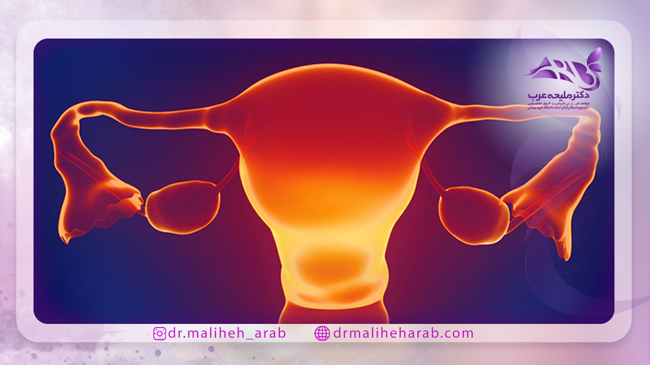 علائم ابتلا به تنبلی تخمدان
