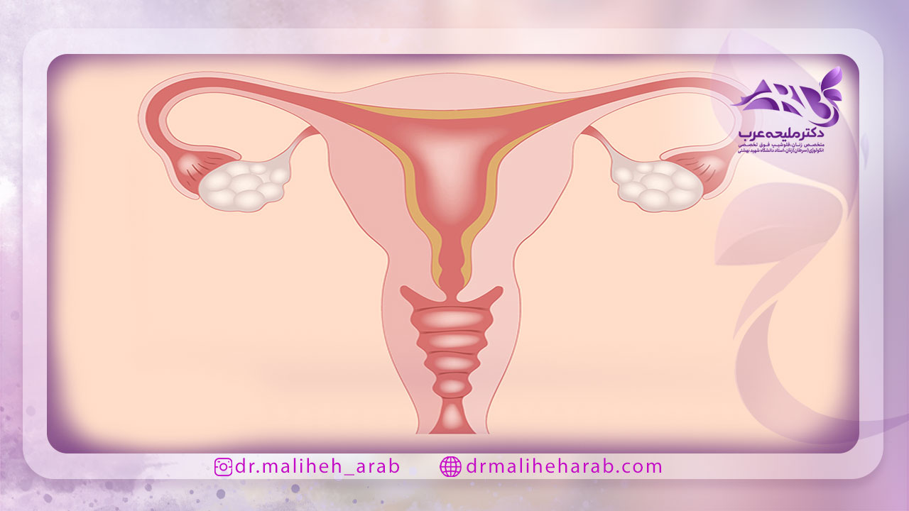 علت تنبلی تخمدان