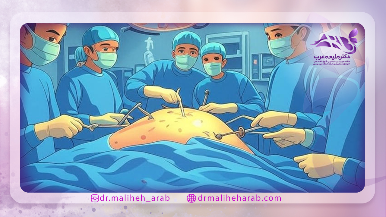 کاهش درد بعد از لاپاراسکوپی کیست تخمدان